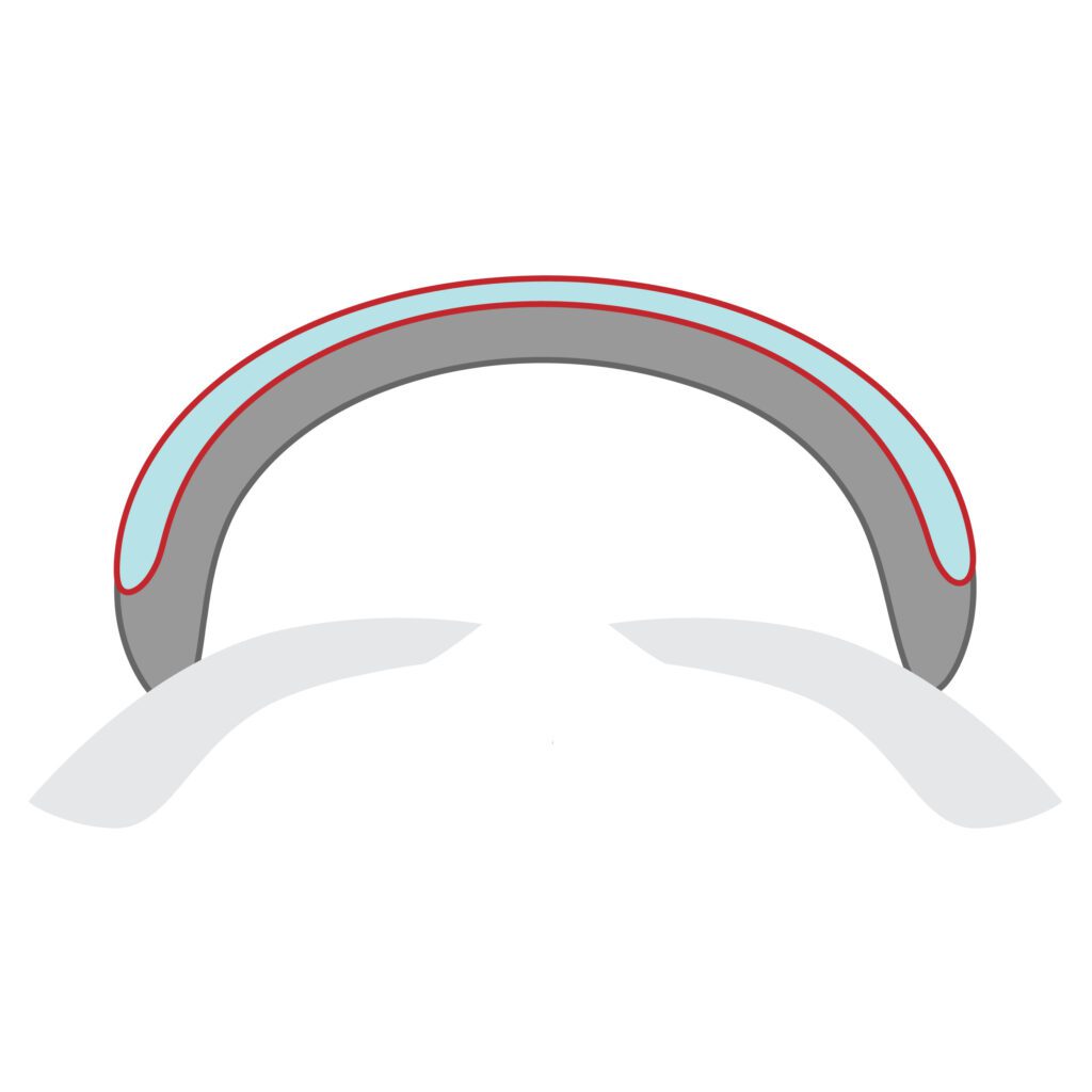 Corneal Transplant Tissue Processing - ALK 