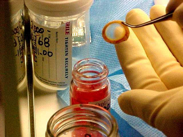 recuperación de córnea 3 (preferido)