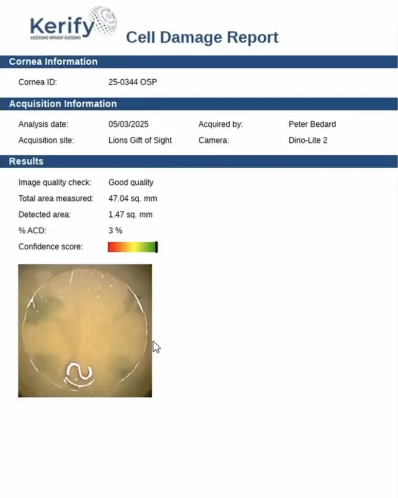 Rapport sur les dommages causés aux cellules de Kerify